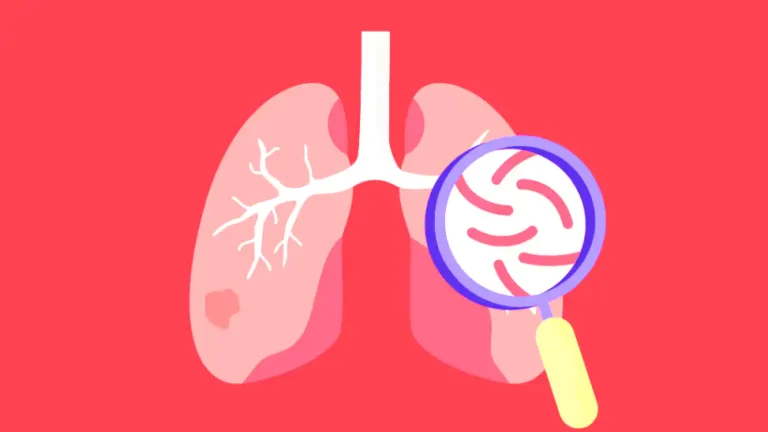 Mengenal Skrining Dini Tuberkulosis: Mengapa Deteksi Cepat Sangat Penting?