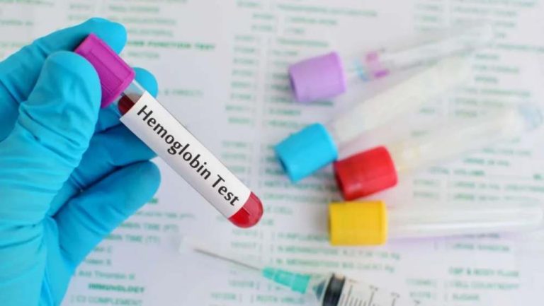 Tak Perlu Lagi Takut Jarum, Kini Hemoglobin Bisa Dicek Lewat Ujung Jari 